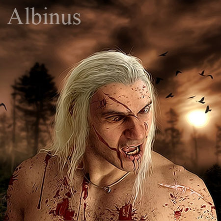 Albinus